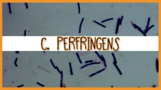 Clostridium Perfringens