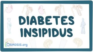 Diabetes insipidus – causes, symptoms, diagnosis, treatment, pathology