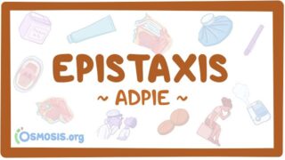 Epistaxis: Nursing Process