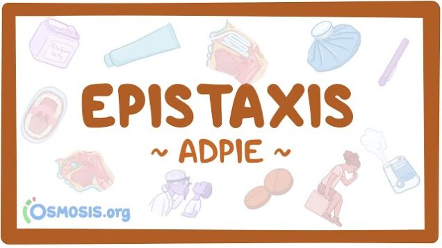 Epistaxis: Nursing Process