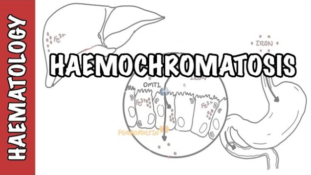 Haemochromatosis (Iron Overload) – iron physiology, causes and pathophysiology