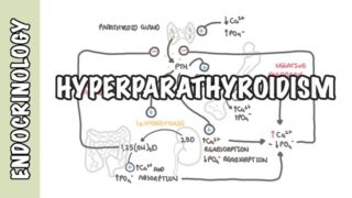 Hyperparathyroidism and the different types, causes, pathophysiology, treatment