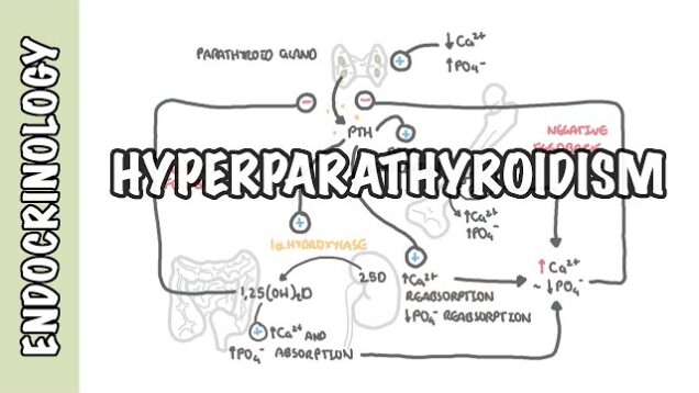 Hyperparathyroidism and the different types, causes, pathophysiology, treatment