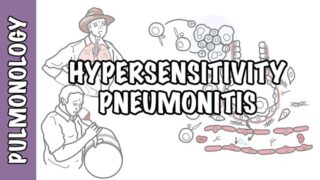Hypersensitivity pneumonitis