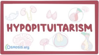Hypopituitarism – causes, symptoms, diagnosis, treatment, pathology