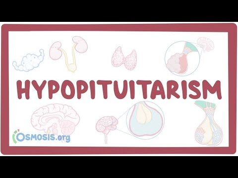 Hypopituitarism – causes, symptoms, diagnosis, treatment, pathology