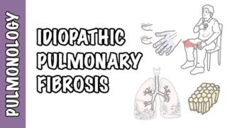 Idiopathic Pulmonary Fibrosis – pathophysiology, signs and symptoms, investigation and treatment