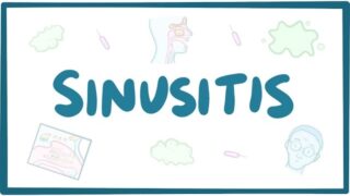 Sinusitis – causes, symptoms, diagnosis, treatment, pathology