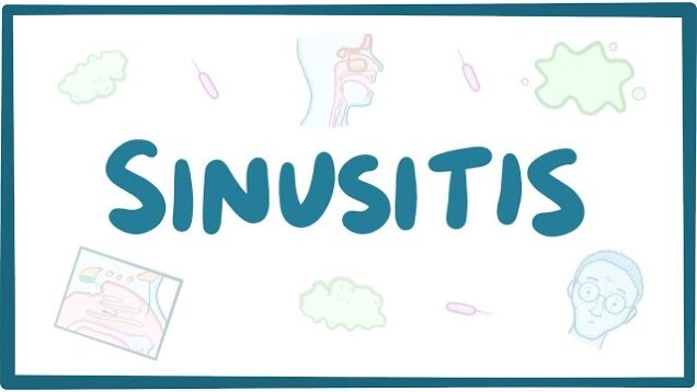 Sinusitis – causes, symptoms, diagnosis, treatment, pathology