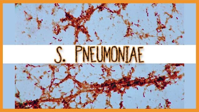 Streptococcus Pneumoniae
