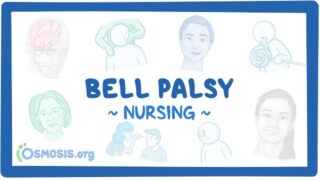 Bell Palsy: Clinical Nursing Care