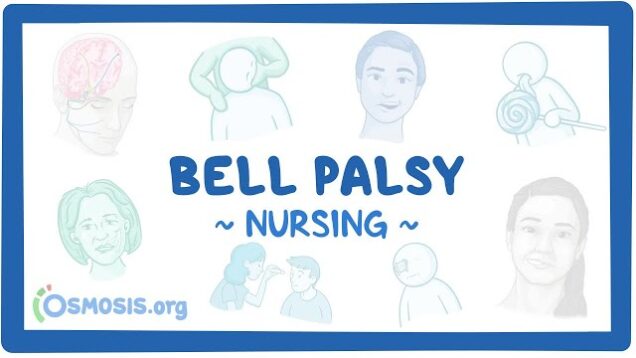Bell Palsy: Clinical Nursing Care