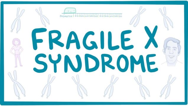 Fragile X Syndrome – causes, symptoms, diagnosis, treatment, pathology