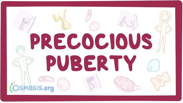 Precocious puberty (Year of the Zebra)