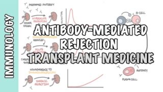 Transplant Medicine – Antibody mediated rejection